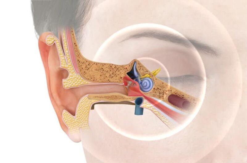 Tinnitus Assessment