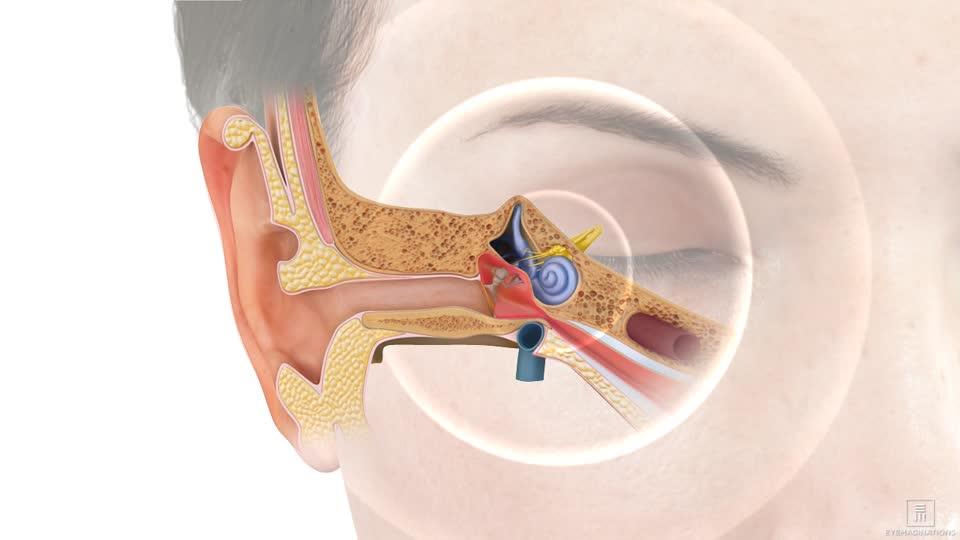 Tinnitus Assessment