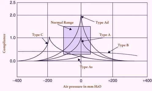 Impedance Audiometry Tests