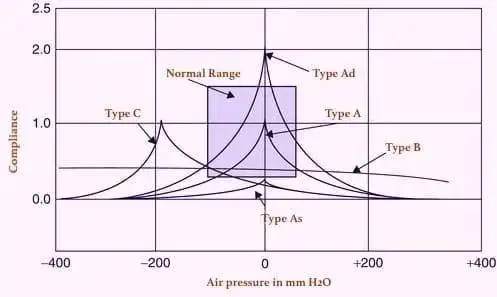 Impedance Audiometry Tests